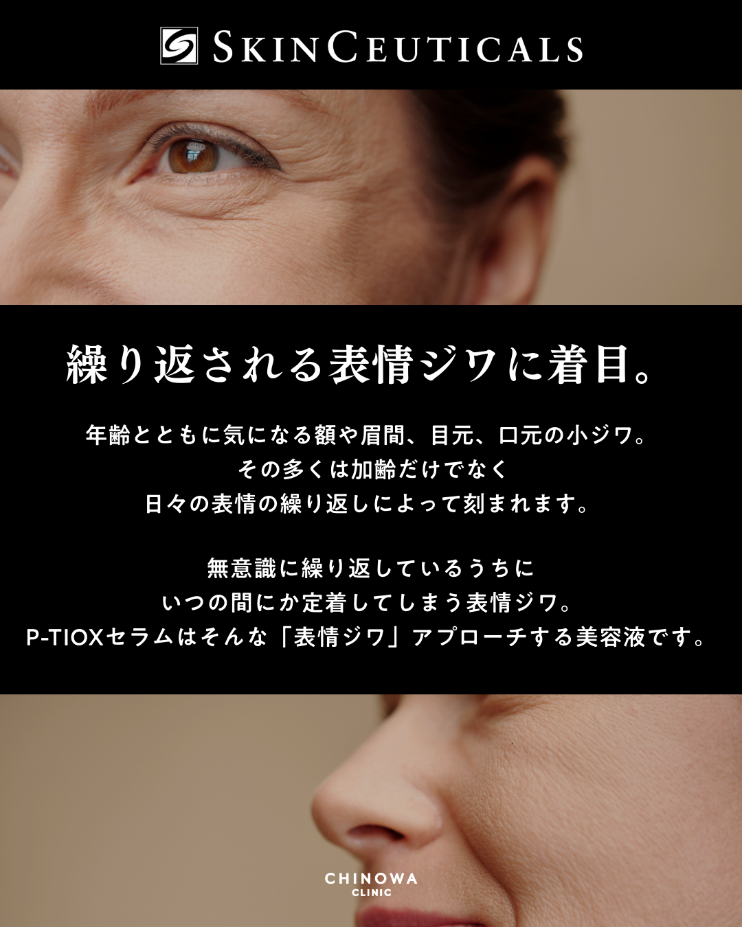 スキンシューティカルズ P-TIOXセラム