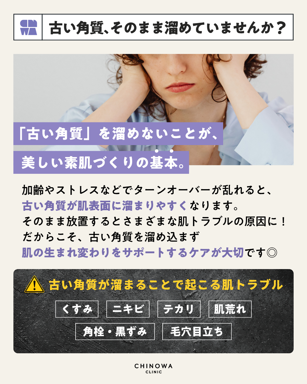 サンソリット ウルピールフォーム【単品】