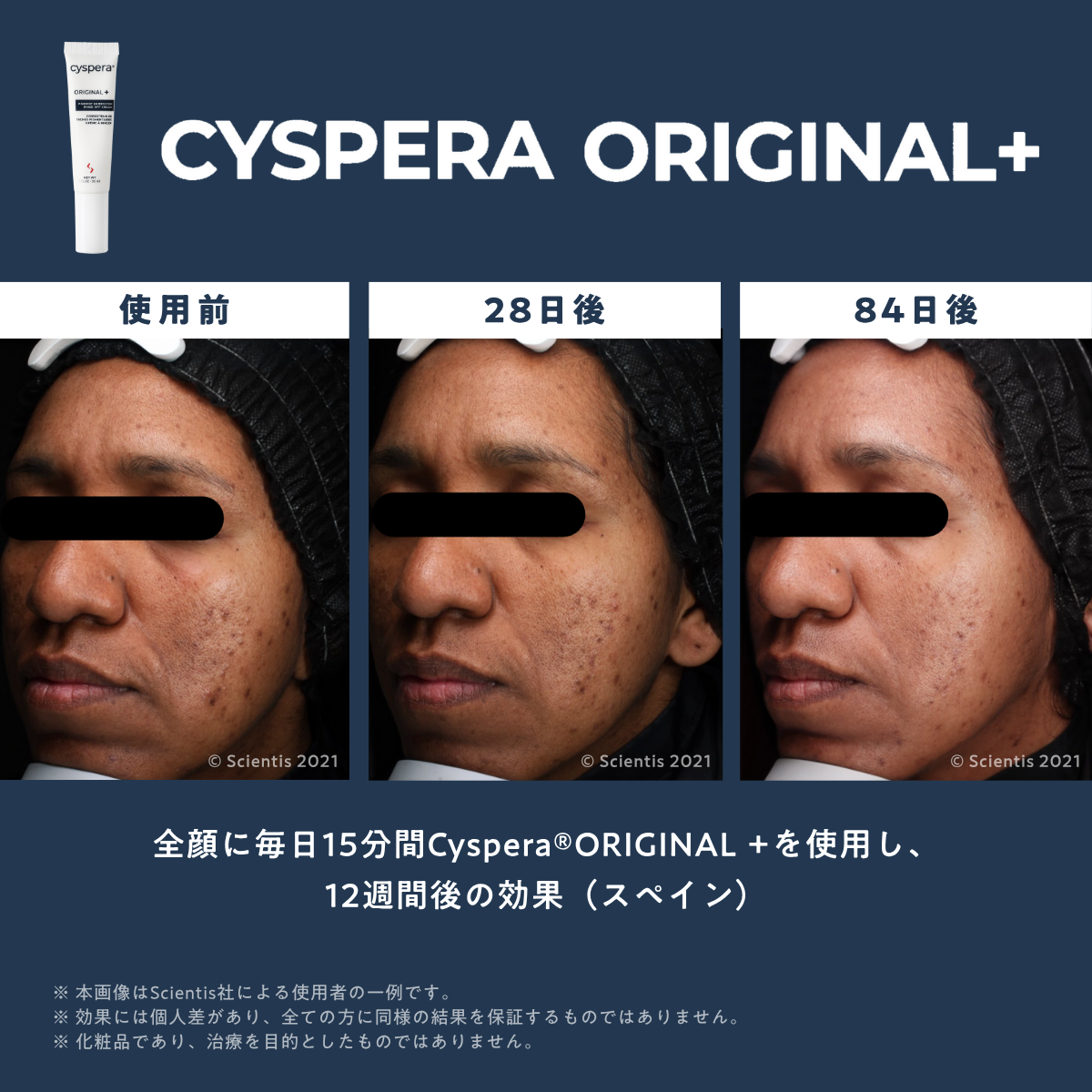 シスペラ オリジナルプラス(Cyspera Original+)