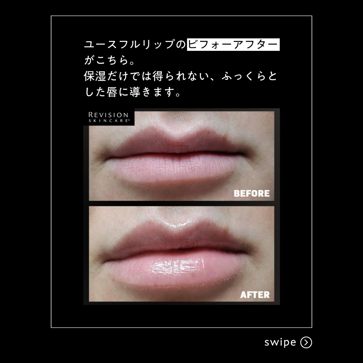 リビジョンスキンケア ユースフルリップ <クリア>