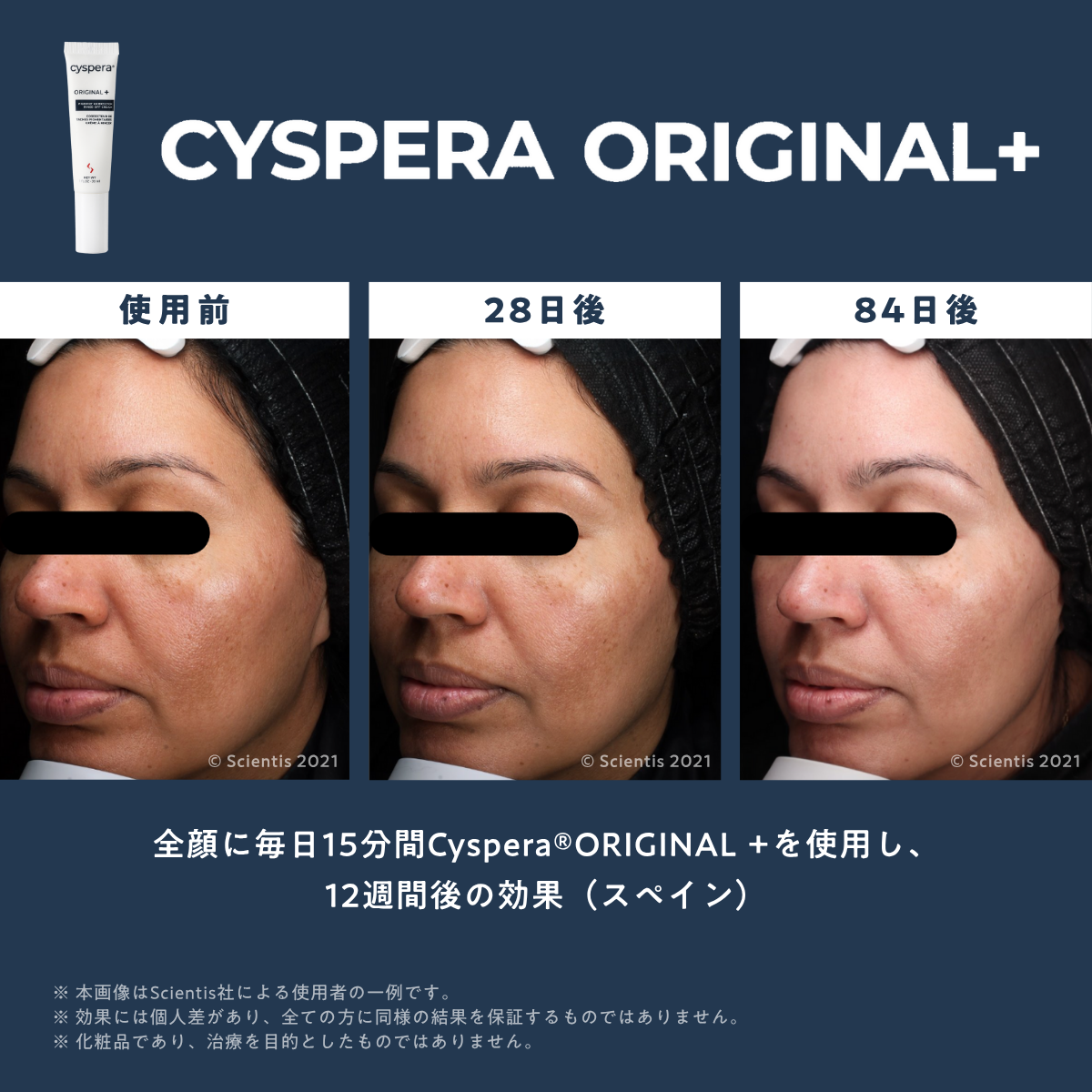 シスペラ オリジナルプラス（Cyspera Original+）