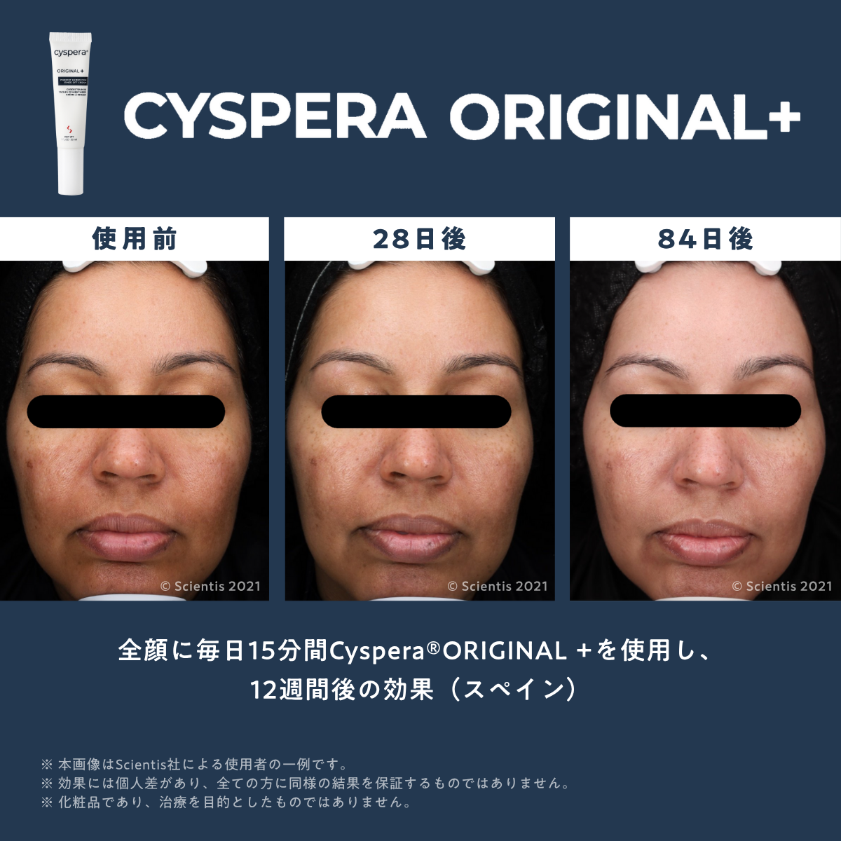 シスペラ オリジナルプラス（Cyspera Original+）