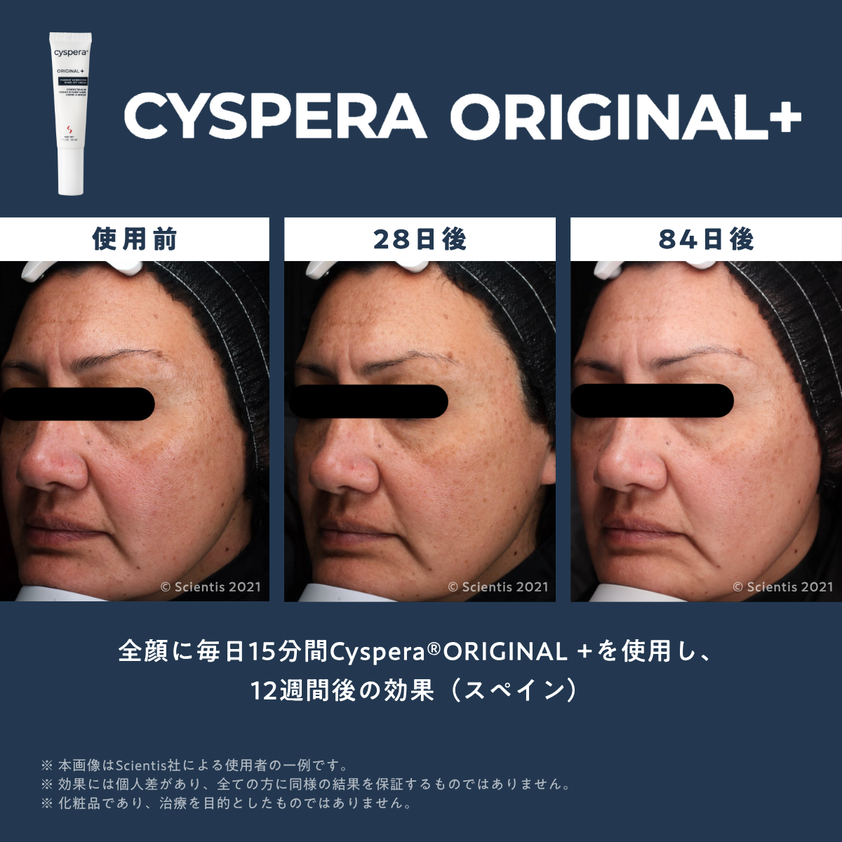 シスペラ オリジナルプラス（Cyspera Original+）